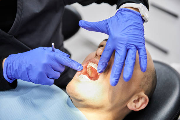 Best Emergency Treatment for Dental Infections or Abscesses in North Aurora, IL
